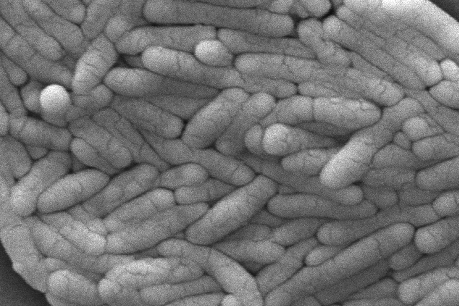 FILE - This 2009 electron microscope image provided by the Centers for Disease Control and Prevention shows a large group of Gram-negative Salmonella typhimurium bacteria that had been isolated from a pure culture. (Janice Haney Carr/CDC via AP