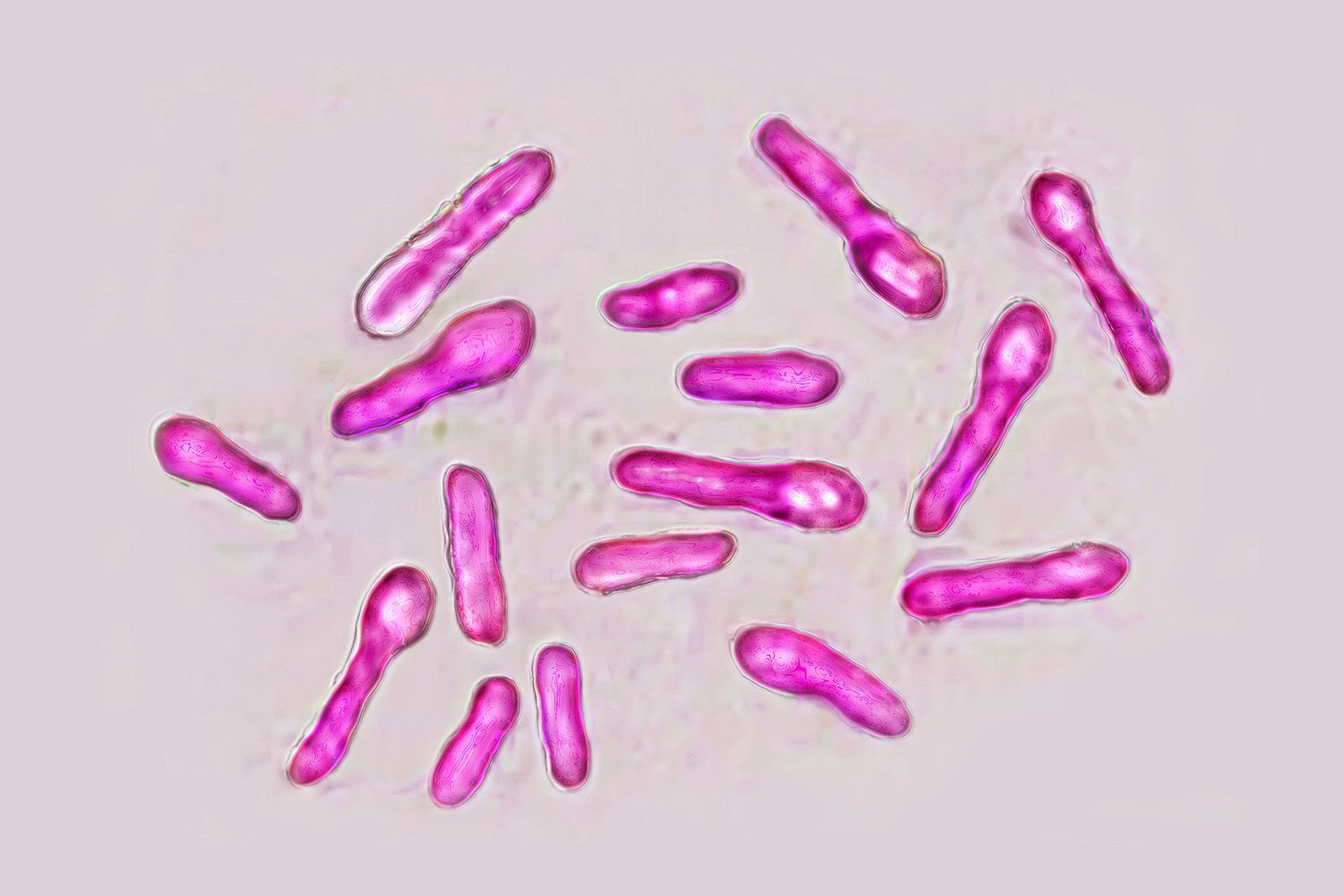 <i>BSIP/Universal Images Group Editorial/Getty Images via CNN Newsource</i><br/>Clostridium botulinum bacteria (botulism bacillus) secretes a very powerful toxin (botox)