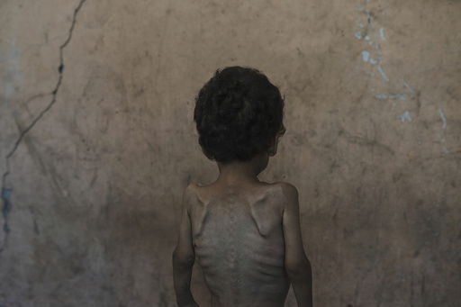 Yazan Abu Ful