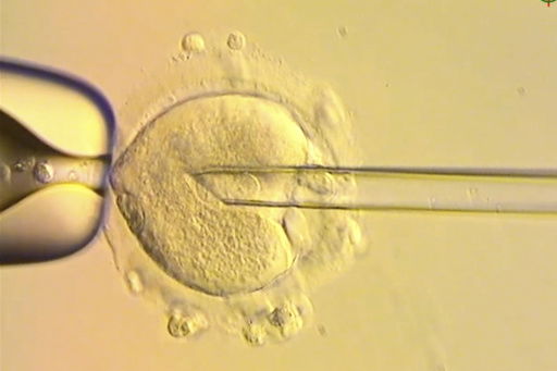 This image from video provided by the Newcastle Fertility Centre shows a nuclear genome from an egg carrying a mitochondrial DNA mutation being inserted into an egg donated by an unaffected woman. (Newcastle Fertility Centre