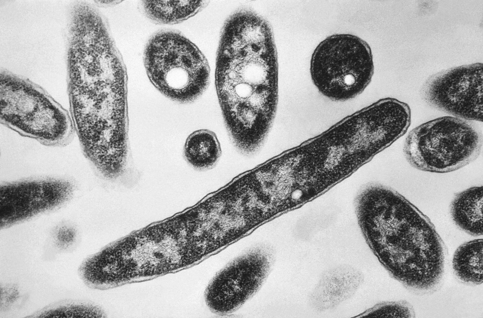 <i>Francis Chandler/CDC/AP via CNN Newsource</i><br/>Legionella bacteria