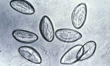 The pinworm is the most common intestinal parasitic worm in the United States.