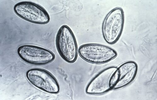 The pinworm is the most common intestinal parasitic worm in the United States.