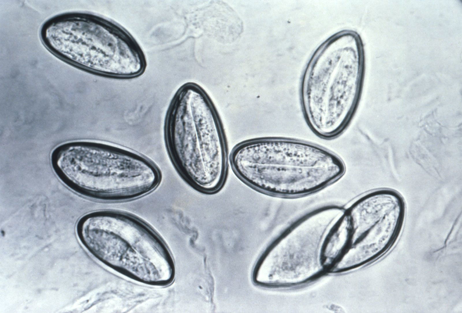 <i>CDC via CNN Newsource</i><br/>The pinworm is the most common intestinal parasitic worm in the United States.