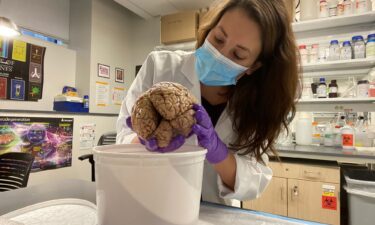 These entorhinal cortex neurons
