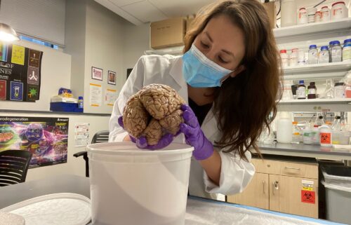 These entorhinal cortex neurons