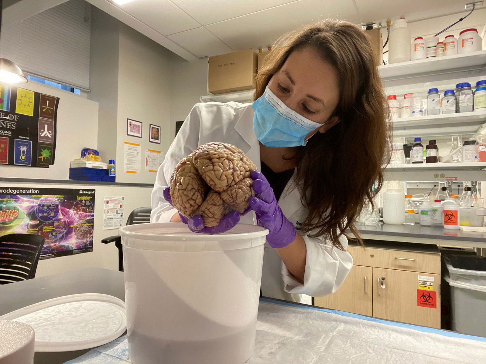 <i>Courtesy Tamar Gefen via CNN Newsource</i><br/>These entorhinal cortex neurons