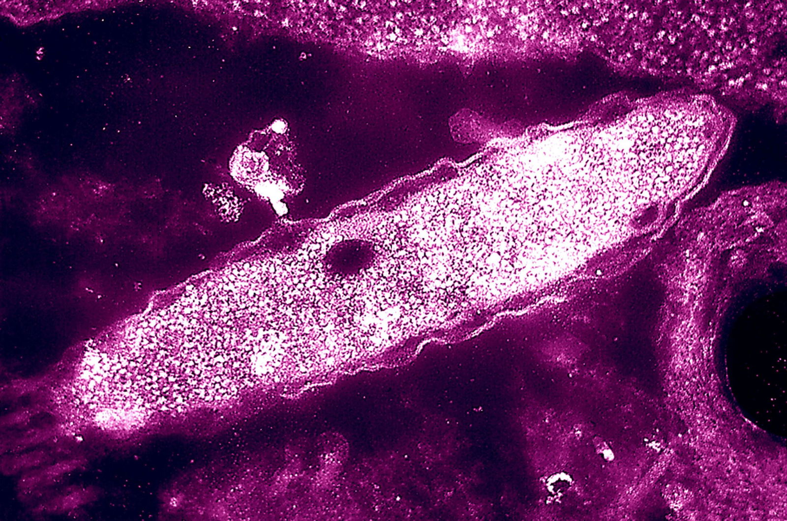 <i>BSIP/UIG/Getty Images via CNN Newsource</i><br/>The New. York City Department of Health says there have been 99 cases of Legionnaires' disease