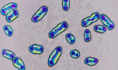Plague is caused by the bacteria Yersinia pestis and is spread to humans through infected flea bites or contact with infected animals.