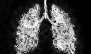 Smoking is a major risk factor for developing chronic obstructive pulmonary disease