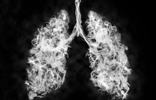 Smoking is a major risk factor for developing chronic obstructive pulmonary disease