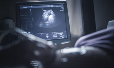 The latest recommendations from ACOG say that any of the available Covid-19 vaccines can be delivered simultaneously with other vaccines recommended during pregnancy.