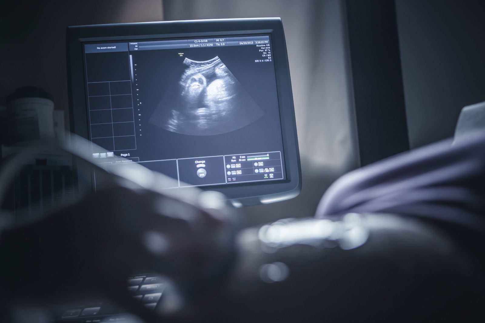 <i>John Fedele/Tetra images RF/Getty Images via CNN Newsource</i><br/>The latest recommendations from ACOG say that any of the available Covid-19 vaccines can be delivered simultaneously with other vaccines recommended during pregnancy.